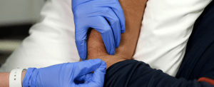 Close of up dry needling in arm